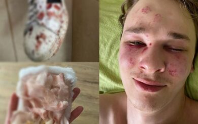 На Закарпатье парень совершил попытку суицида в ТЦК