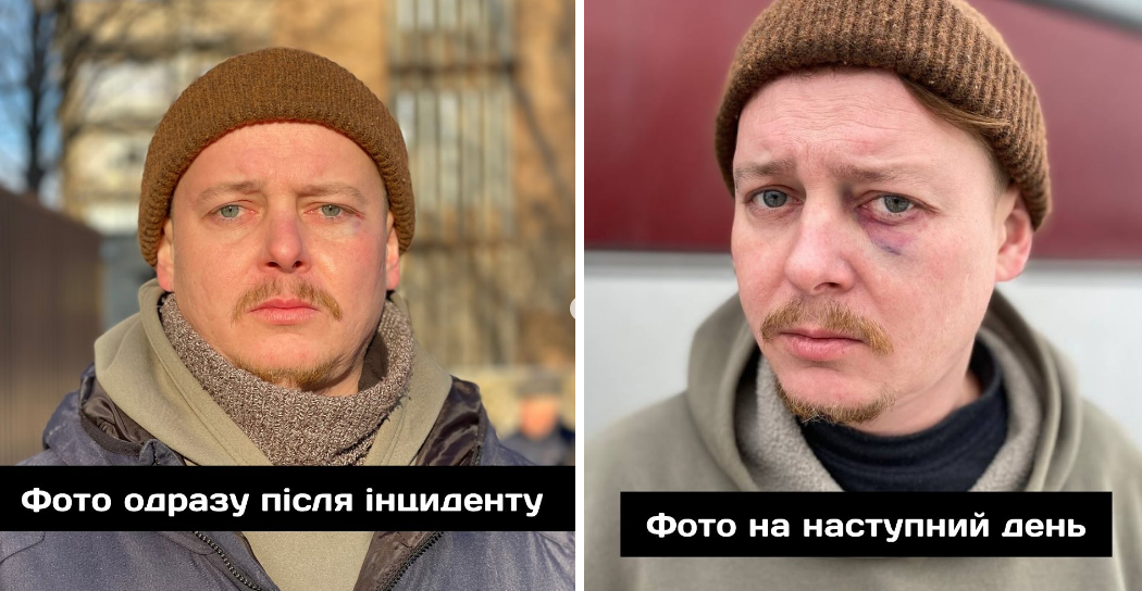 В Днепре директора оперного театра обвиняют в избиении актера