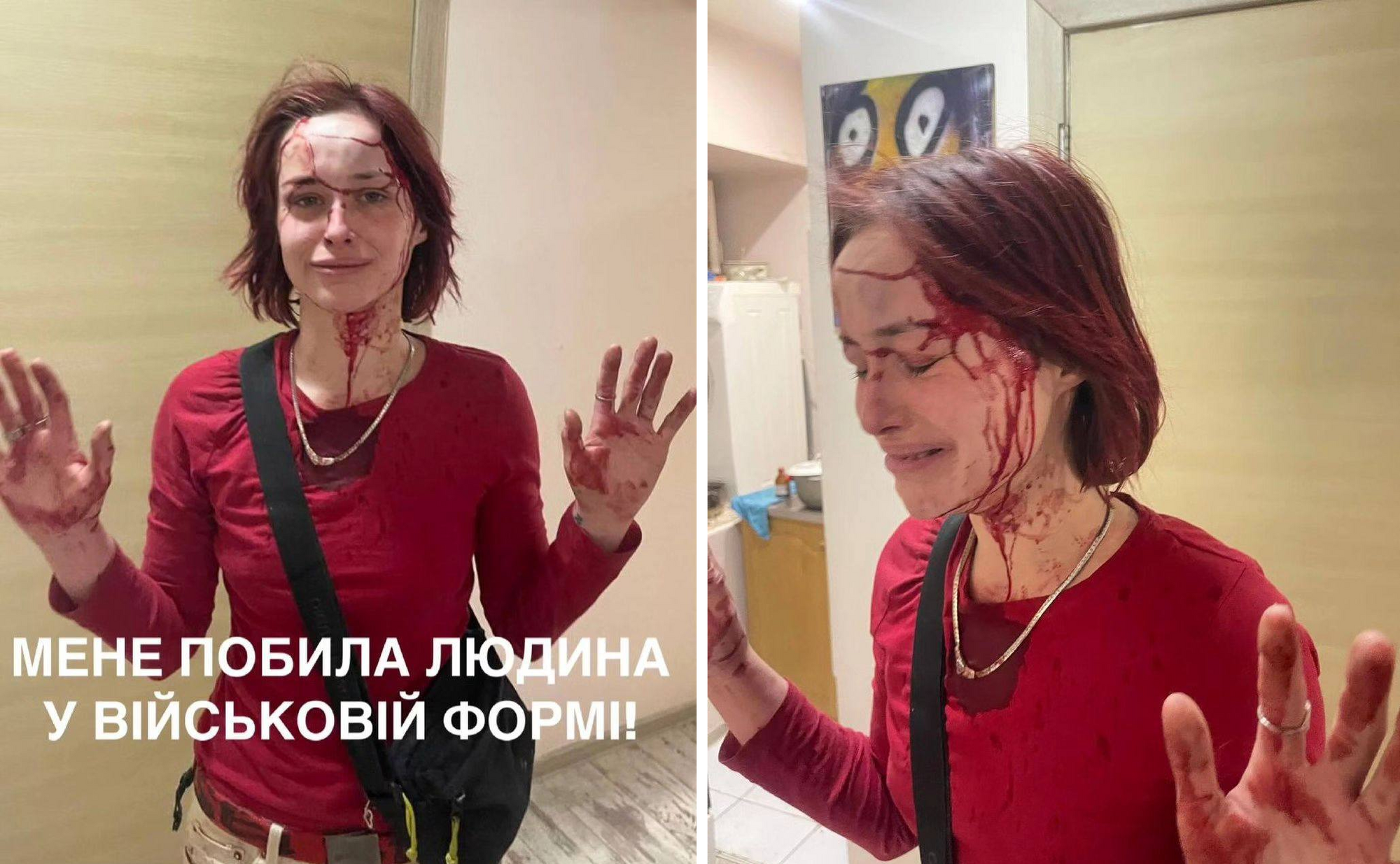 Одесситка утверждает, что работник военкомата избил ее: областной ТЦК и СП начал служебную проверку