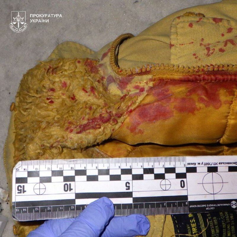 В Киеве мужчина канцелярским ножом изуродовал лицо 17-летнего подростка