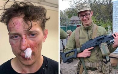 В Киеве неизвестные избили эксвоеннослужащего из-за прически: правоохранители начали расследование