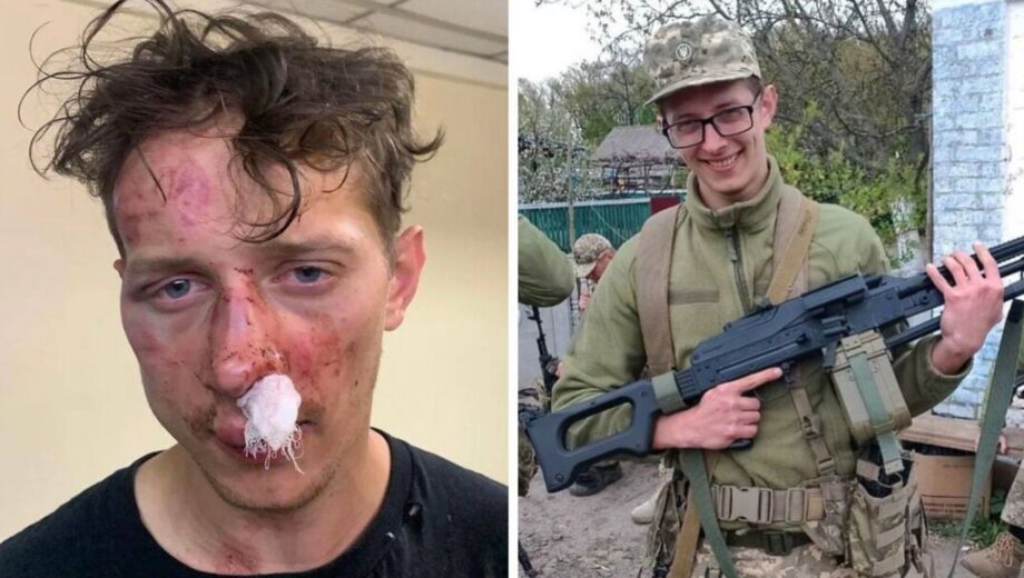 В Киеве неизвестные избили эксвоеннослужащего из-за прически: правоохранители начали расследование
