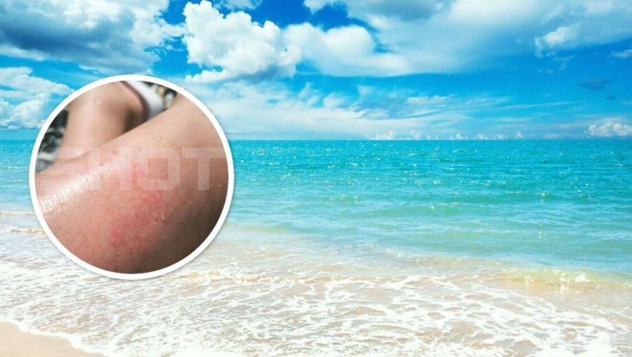 У громадян рф фіксують масову алергію на … море