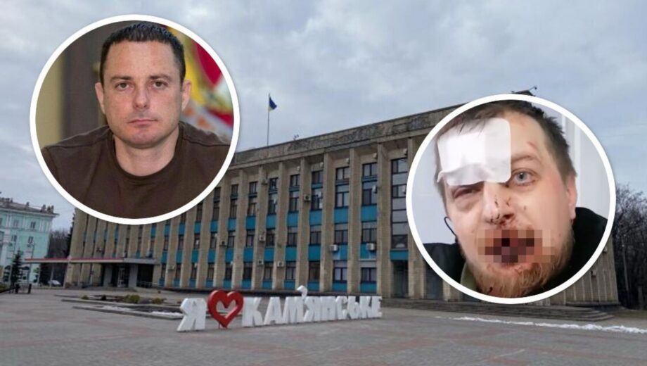 У Кам’янському побили учасника акції ”Гроші на ЗСУ”: до нападу може бути причетна міська влада?