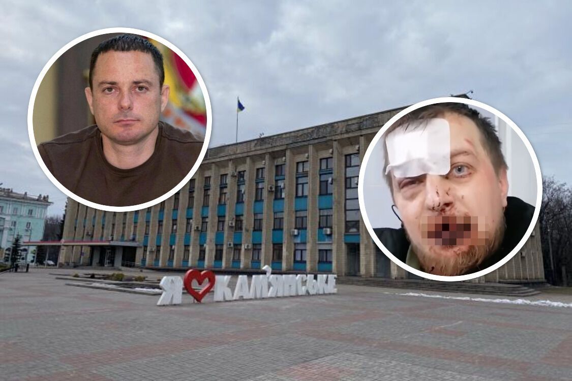 В Каменском напали на участника акции ''Деньги на ВСУ''