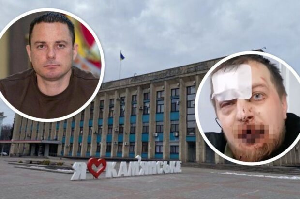 В Каменском избили участника акции »Деньги на ВСУ»: к нападению могут быть причастны городские власти?