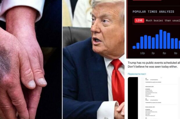 Слухи о здоровье Трампа: соцсети обсуждают кровоподтеки на руках и его исчезновение