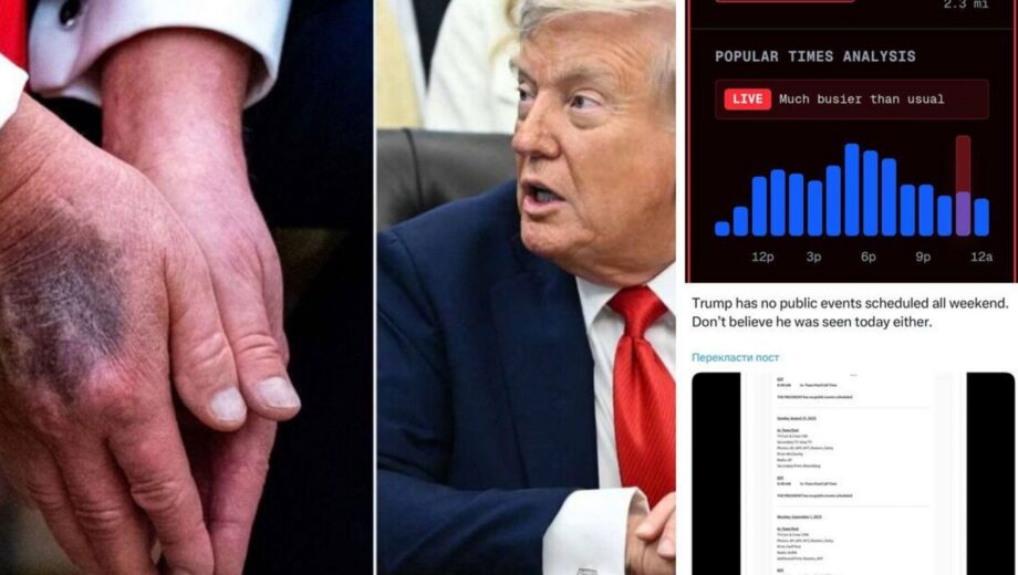 Слухи о здоровье Трампа: соцсети обсуждают кровоподтеки на руках и его исчезновение