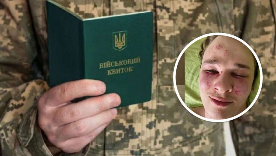 ”Поводив себе неадекватно”: у ТЦК прокоментували спробу суїциду призовника на Закарпатті