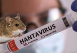 Температура, нудота і біль у м’язах: на Львівщині зафіксували небезпечну інфекцію