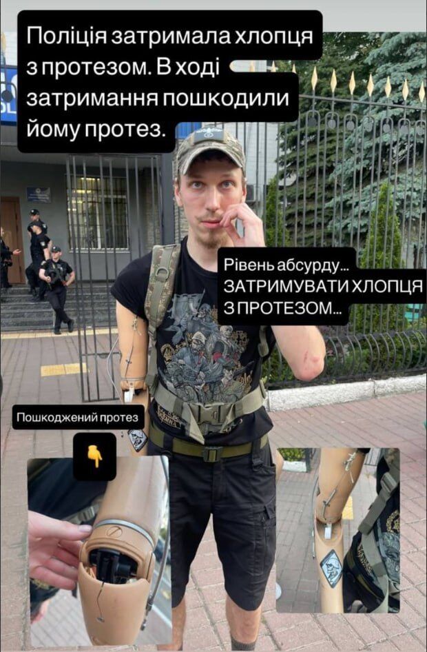 Після сутичок на ''КиївПрайді'' поліція звинуватила ветерана з протезом  у травмуванні силовика