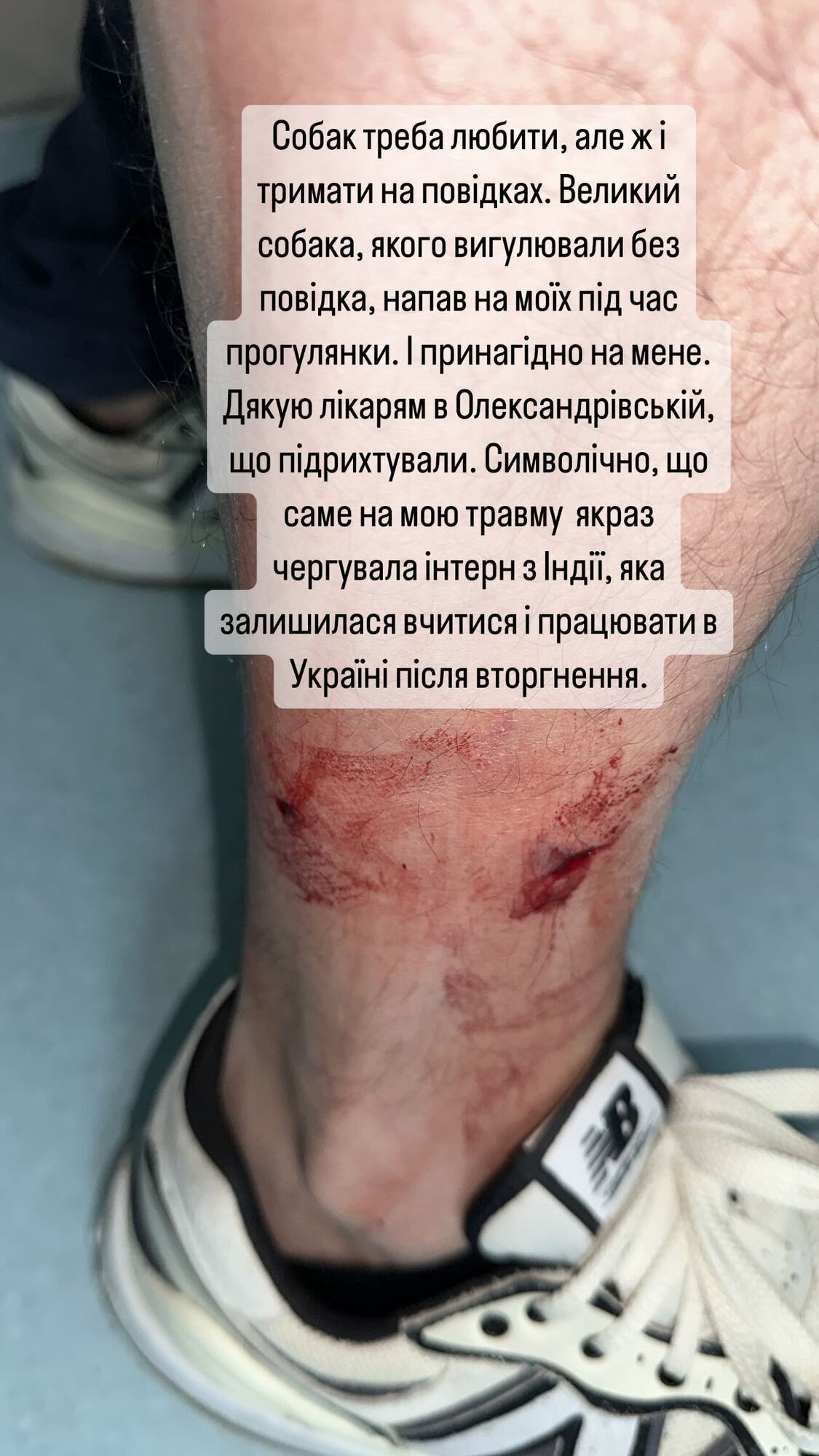На министра Кулебу напала собака: чиновник оказался в больнице