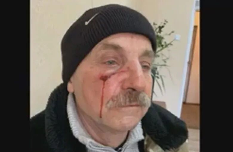 Ігор Кирилов після побиття депутатом у приміщенні міської ради