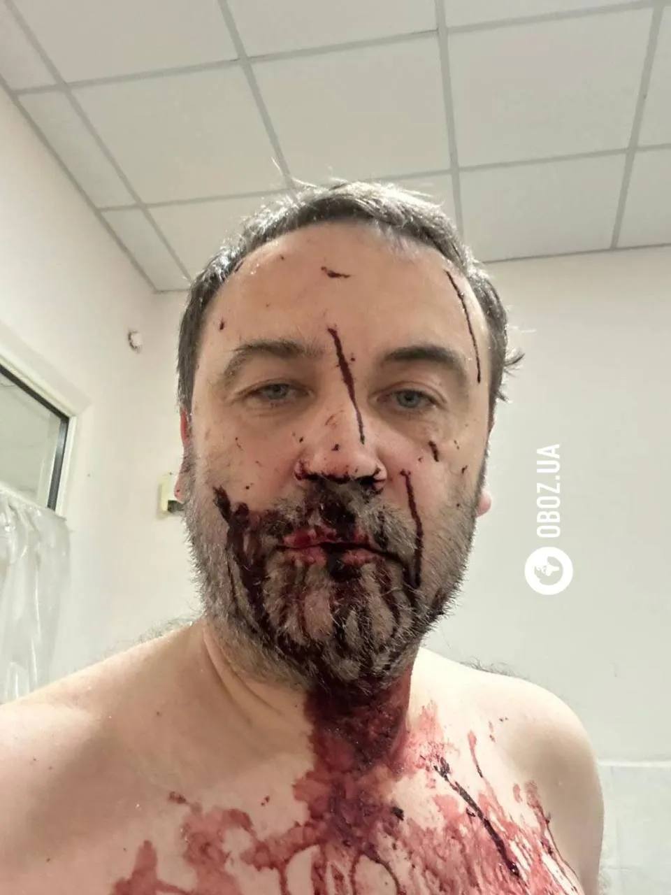 Дрон-камикадзе атаковал дом российского оппозиционера Пономарева в окрестностях Киева