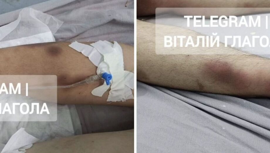 Смерть мобилизованного после ТЦК в Закарпатье: полиция назвала новые детали дела