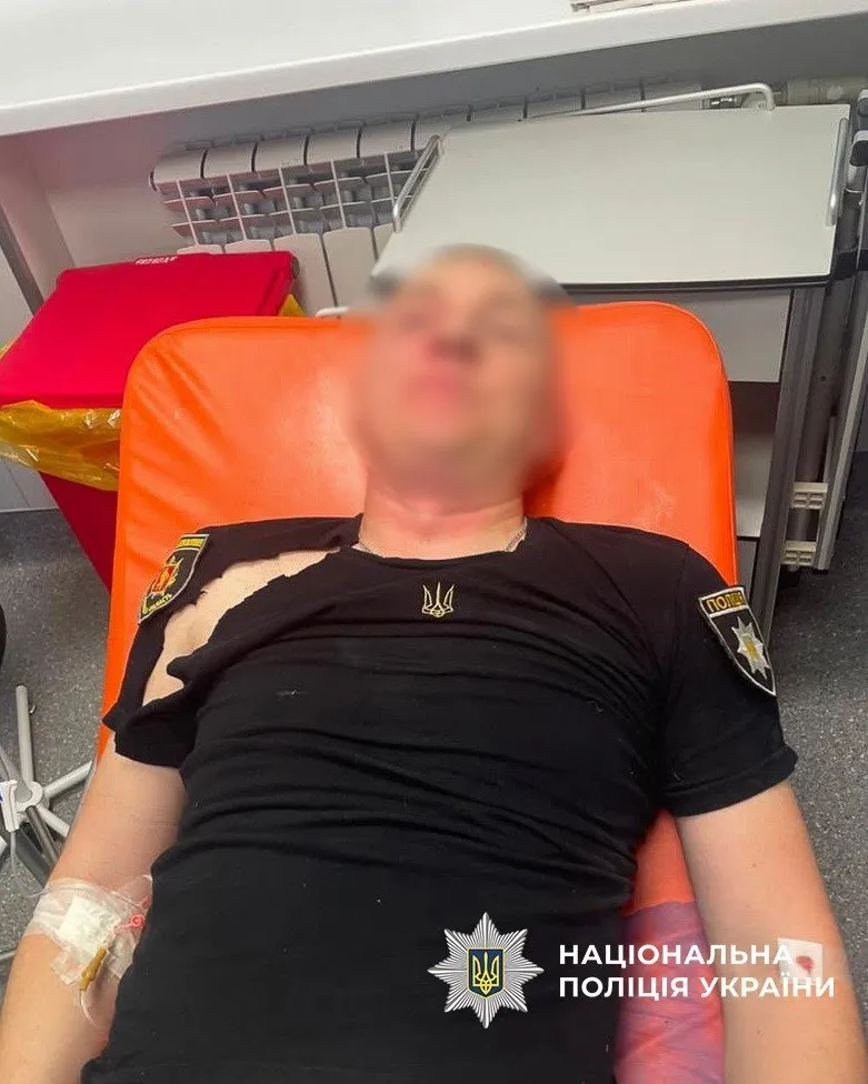 В Запорожье мужчина атаковал полицейских газом и ножом: что известно об инциденте