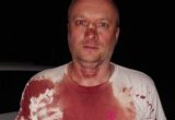 »Наглое нападение группой лиц» на военнослужащего: офицера ВСУ, похоже, незаконно 3 месяца удерживают в СИЗО